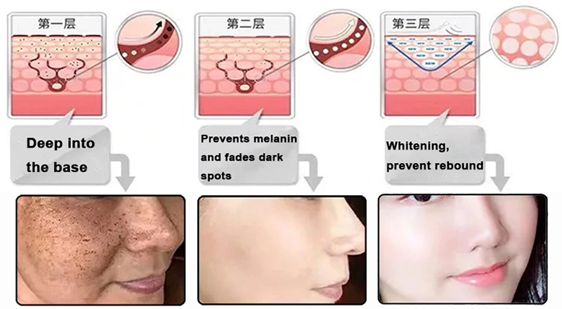 Nine peptides powder Whitening Nine peptides powder Whitening